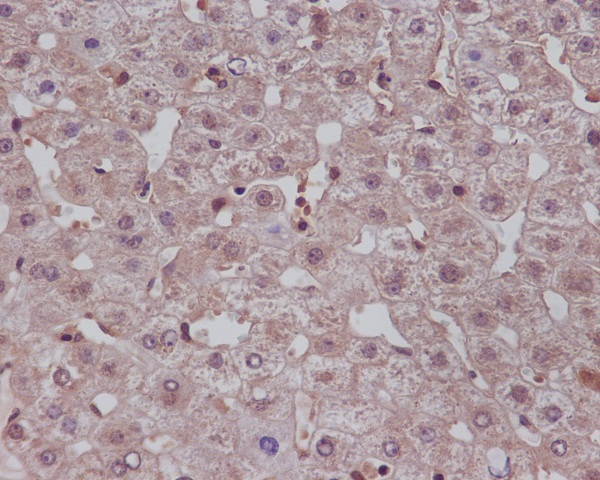 IHC - Notch1 Antibody AP90290